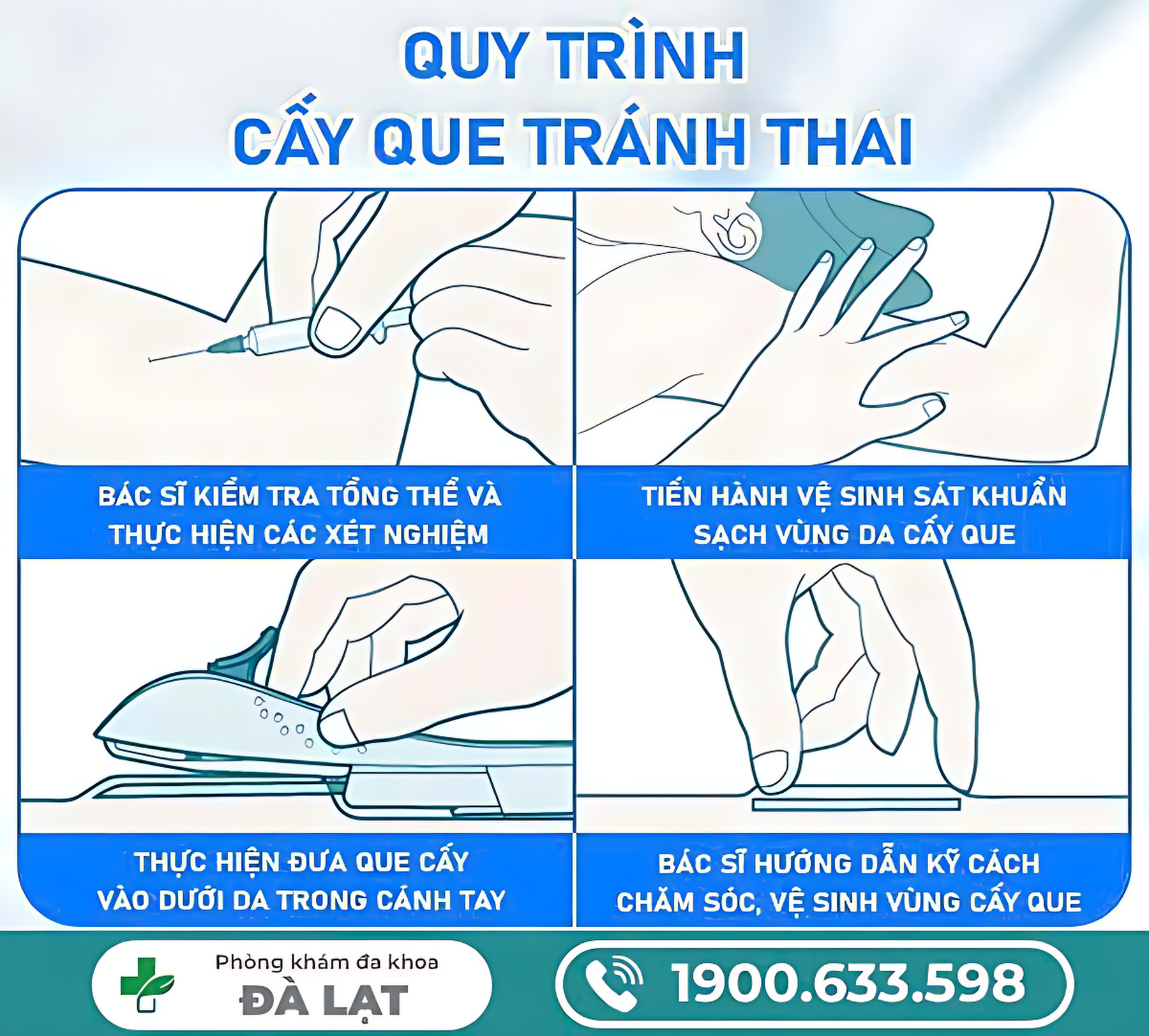 Hình ảnh minh họa